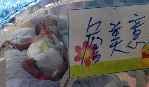 早产儿烧伤事发6天后家长才获知 护士操作失误点燃纸尿裤