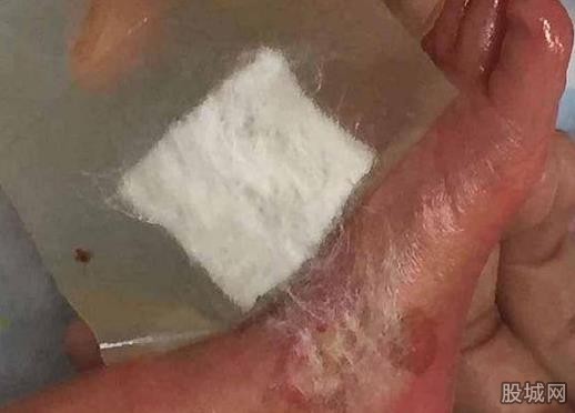 早产儿被护士烧伤 扣除当月绩效难道这就是医院的措词?
