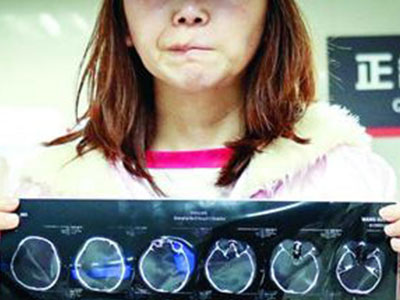 女子整容失败维权被关 爱美整容却是噩梦开始