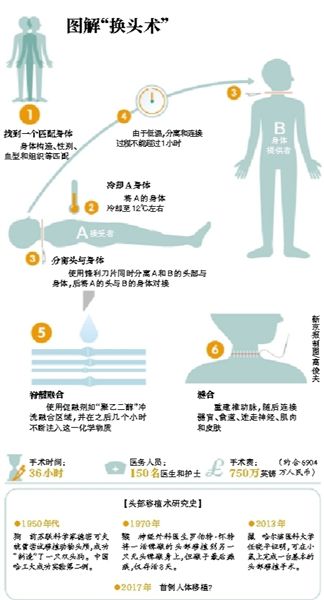 换头，《聊斋志异》中有这样一个<a href='http://www.bjxxg.cn/beijing/gushi/' target='_blank'><u>故事</u></a>，妙手神医陆判官给书生朱尔旦先是换了一个心脏，令其文思大进考中举人，而后，当书生提到妻子不美时，陆判官为朱妻换上了一颗美人头。换头这一贯穿古今中外的科幻设定，如今可能成为事实，据外媒报道，一名身患霍夫曼肌肉萎缩症的俄罗斯男子欲将自己的“头”交给一名意大利临床医生，以移植一副<a href='http://www.bjxxg.cn/health/' target='_blank'><u>健康</u></a>的身体，进行世界上首起“换头术”。