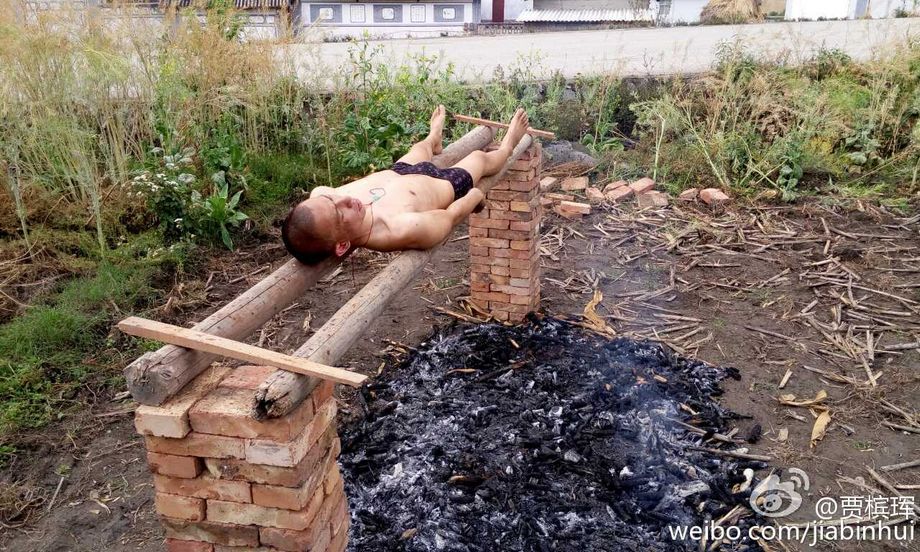 白血病患者42℃高温碳烤白细胞 火烤癌细胞不如吃天然防癌食物