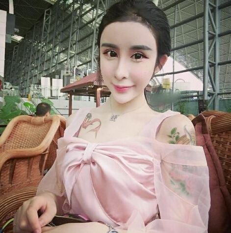 15岁少女整容变“蛇妖”