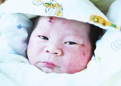 车祸胎儿被撞出奇迹生还 父母却双双遇难