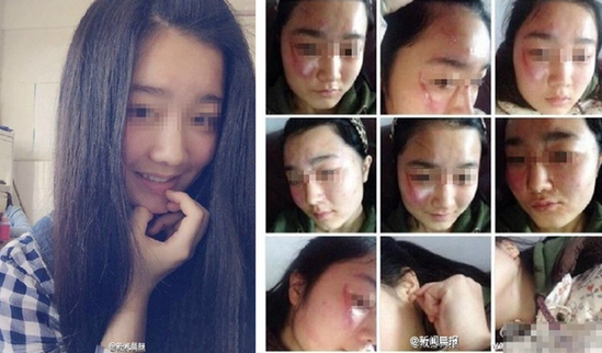 湖北应城一中女教师与女生互殴 女学生被老师打致毁容