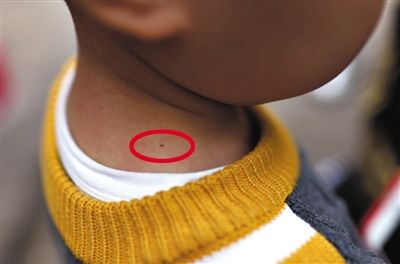 幼儿园老师针扎幼童 容嬷嬷出没家长如何放心？