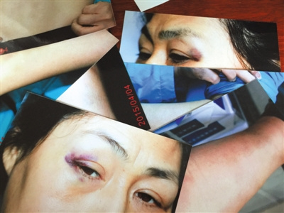 <a href='http://www.bjxxg.cn/news/beijing/' target='_blank'><u>北京</u></a>女律师称遭法官殴打 法院称如查实严肃处理