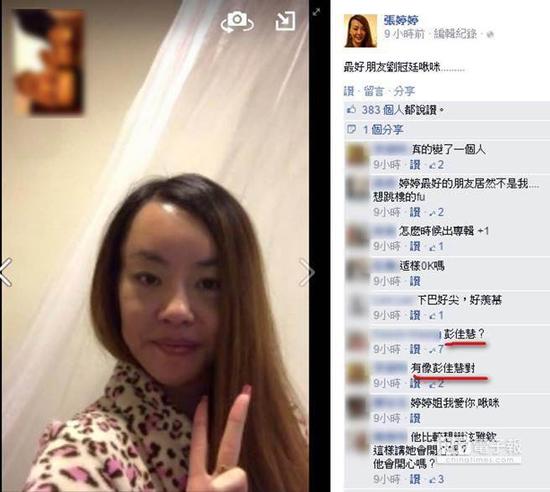 法拉利姐张婷婷整容变彭佳慧 首度上传术后照片自夸“比泫雅还好看”
