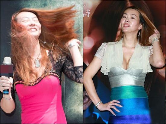 法拉利姐张婷婷整容变彭佳慧 首度上传术后照片自夸“比泫雅还好看”