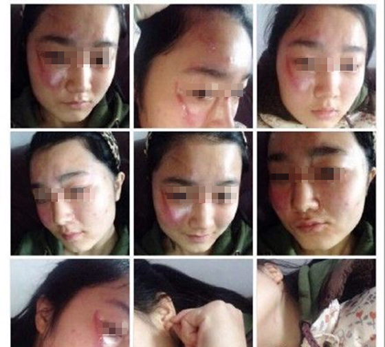 【悲剧】女教师与女生互殴 师生互殴高发凸显制度空缺
