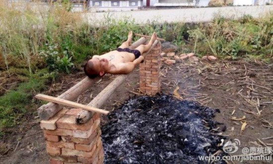 女孩卖拥抱救男友 患白血病花光积蓄曾火烤癌细胞